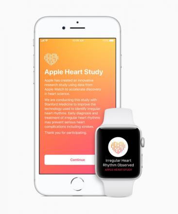 苹果研发先进的心电图心脏监测器，用于未来的苹果手表。
